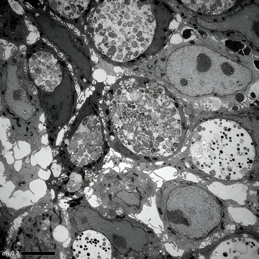 Хламидии скрываются в кишечнике: почему инфекция возвращается после лечения