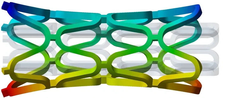 Умные стенты из биополимеров: 3D-печать для сосудов будущего