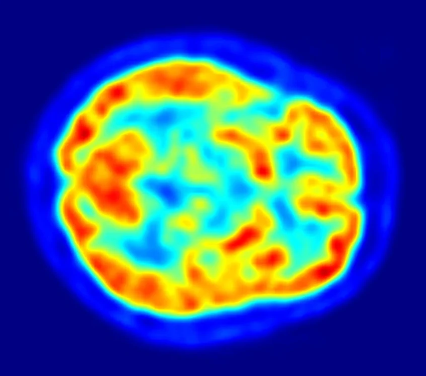 Старение мозга: учёные обнаружили пять разных сценариев угасания разума