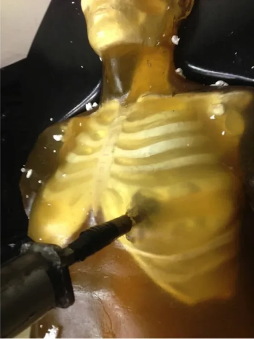 Тасосская загадка: как отверстие в груди раскрыло древнее убийство