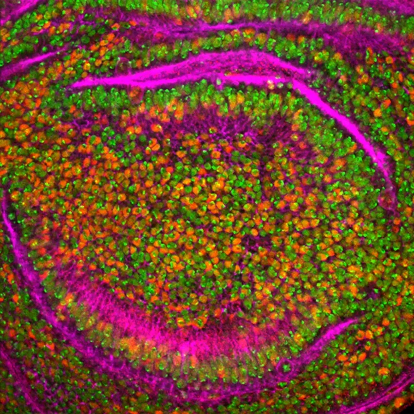 Диета, имитирующая голодание: может ли она помочь в борьбе с раком?