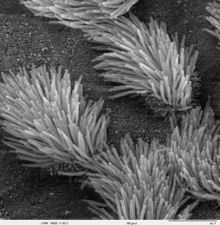 Секрет живого оригами: как плакозоа складывает своё тело без мышц и мозга