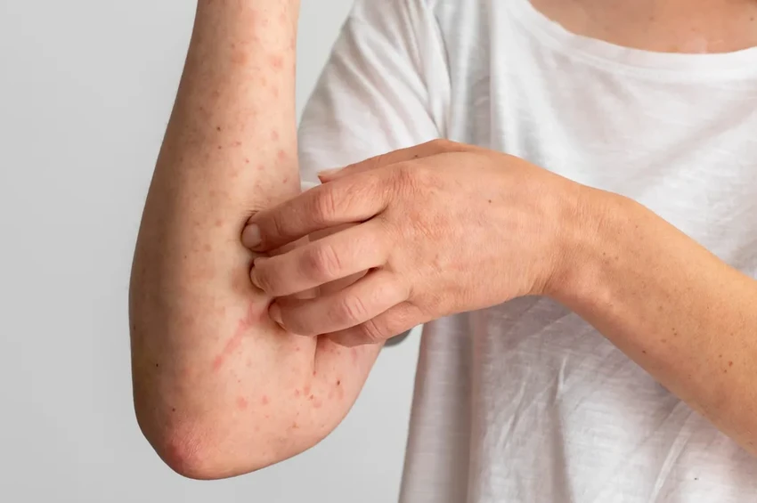 Опасности утягивающего белья: какие проблемы со здоровьем оно вызывает