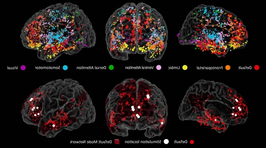 Где в мозге рождается творчество? Новое открытие нейробиологов