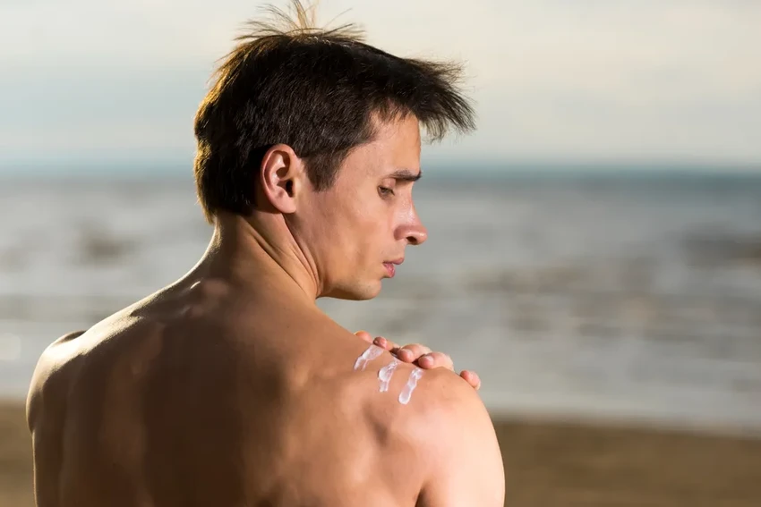 Обгорела и облезает кожа после солнца: как правильно помочь ей восстановиться