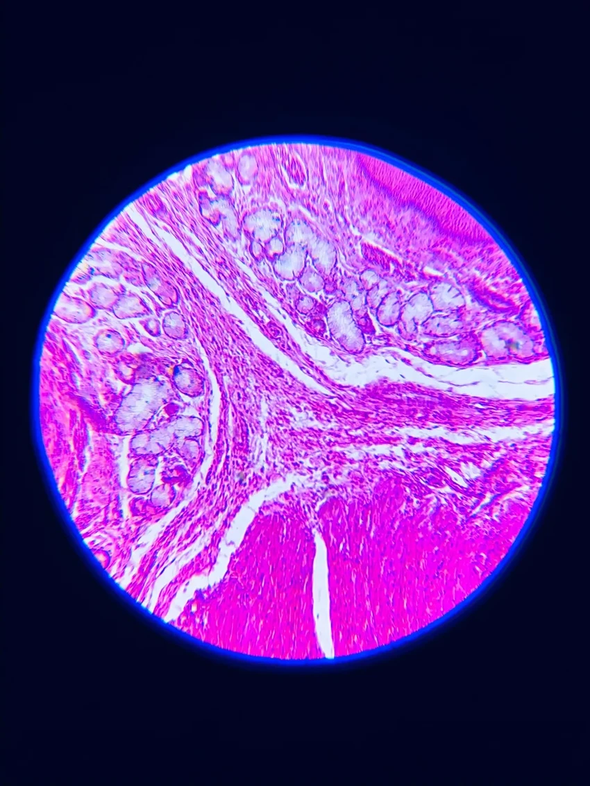 Как отключить один белок, чтобы жир в организме начал сжигать сам себя