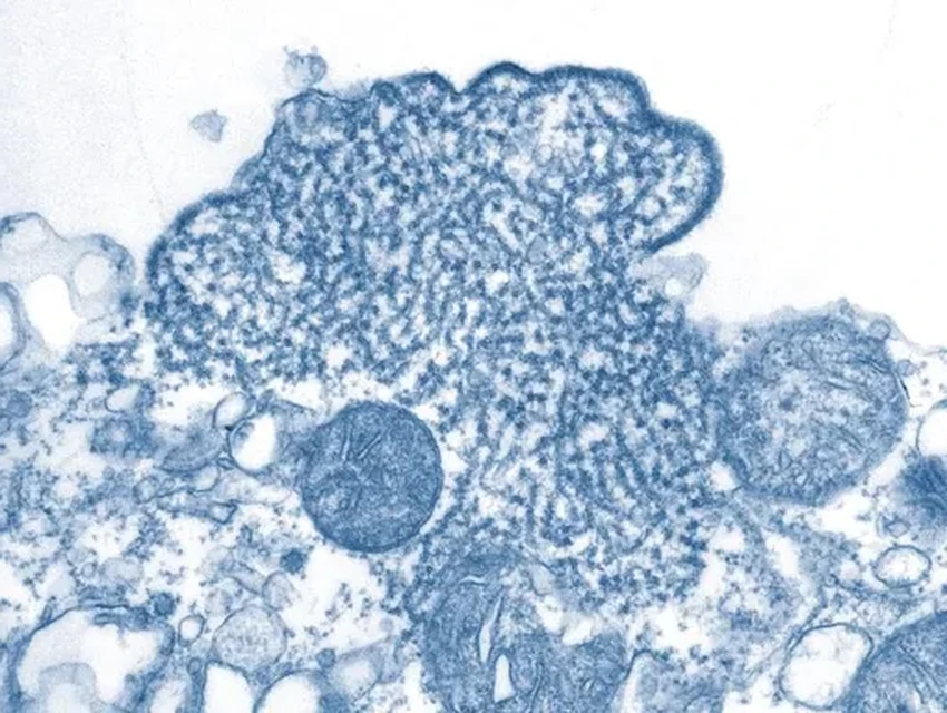 Новое антитело против вируса Нипах: испытания показали 100% выживаемость