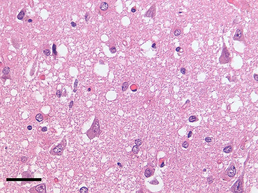 Новый редактор генов остановил смертельные болезни мозга у мышей
