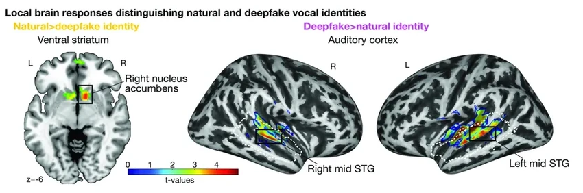 Почему мозг распознаёт дипфейк: границы синтеза искусственного голоса