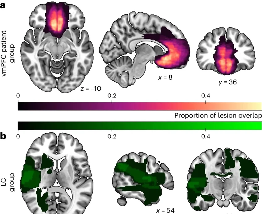Ученые нашли в мозге «центр альтруизма»: почему мы помогаем другим