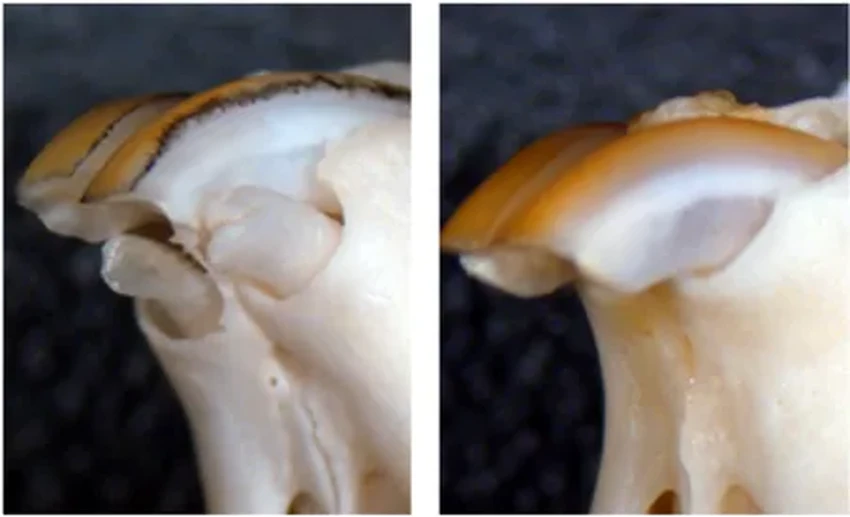 Испытания на людях: препарат для роста новых зубов выходит на новый этап