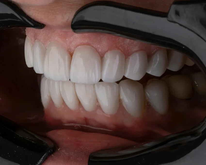 Чай матча защищает десны: научное открытие о пользе полоскания рта