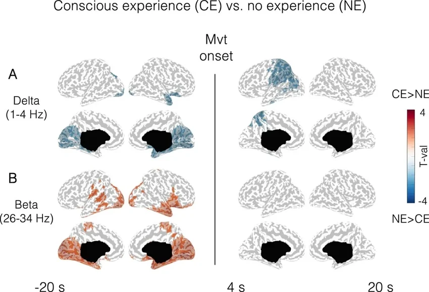 Лунатизм: что на самом деле видит и чувствует мозг во время приступа