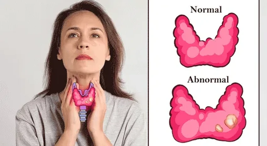 Гипертиреоз: скрытые симптомы, когда срочно нужен эндокринолог