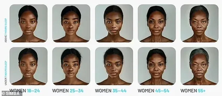 Как хронический недосып старит лицо: визуализация последствий для кожи