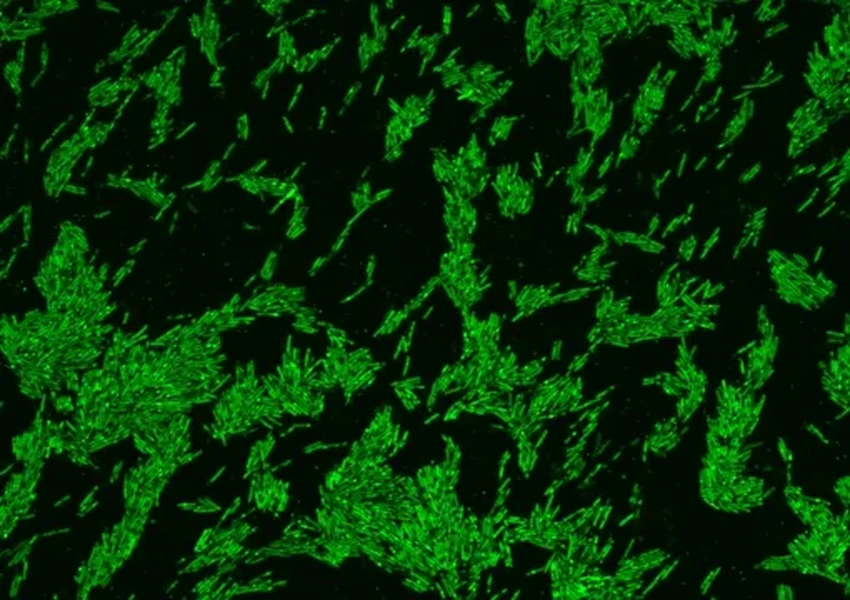 Как микробы в кишечнике помогают бороться с высоким холестерином