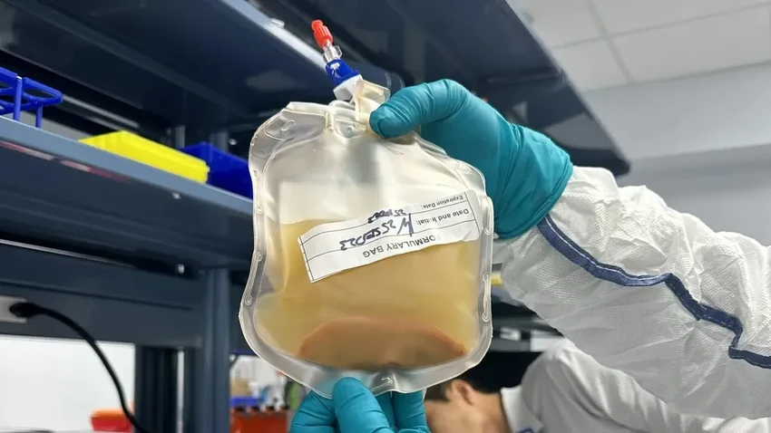 Новая печень из лимфоузла: в США начались испытания революционной терапии