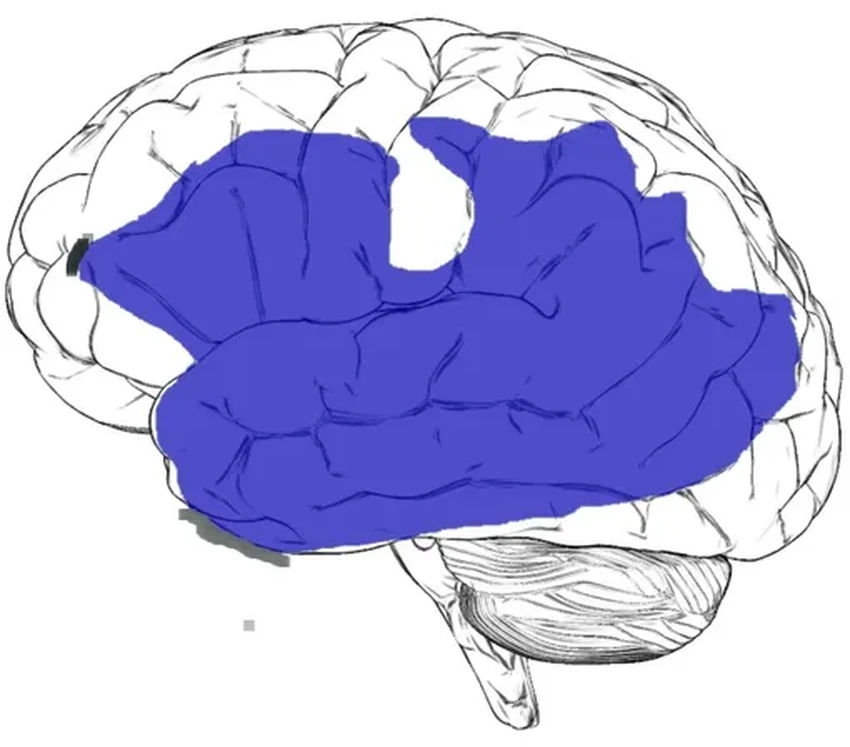 Что такое афазия: как нарушается речь после инсульта или травмы мозга