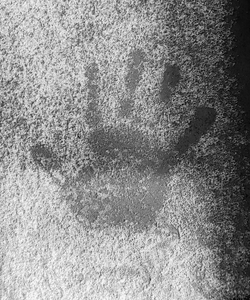 Одобрено первое лекарство от тяжелого обморожения: спасение от ампутации