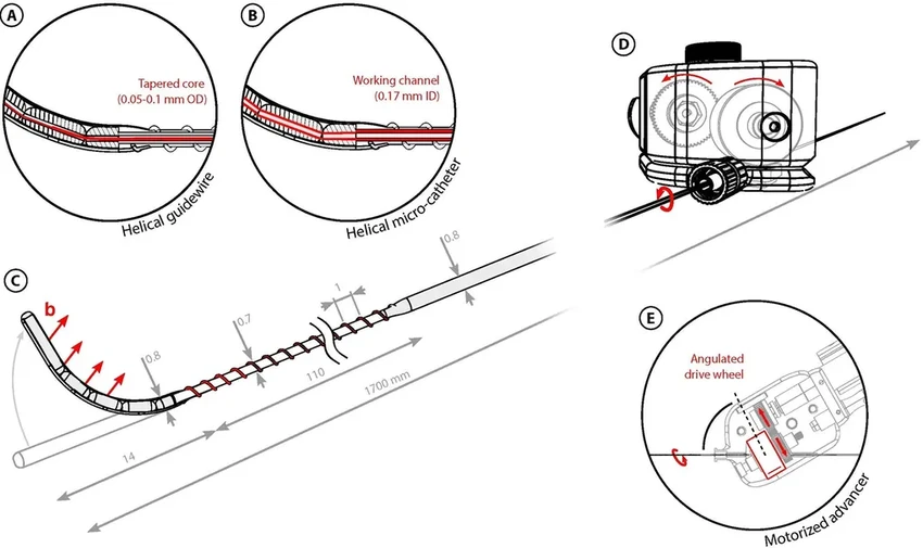 Магнитный робот-спасатель: как он очищает сосуды от тромба при инсульте
