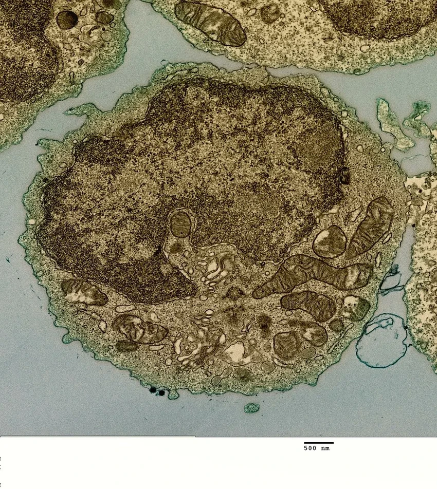 CRISPR-терапия: как редактирование генов лечит врождённый иммунодефицит