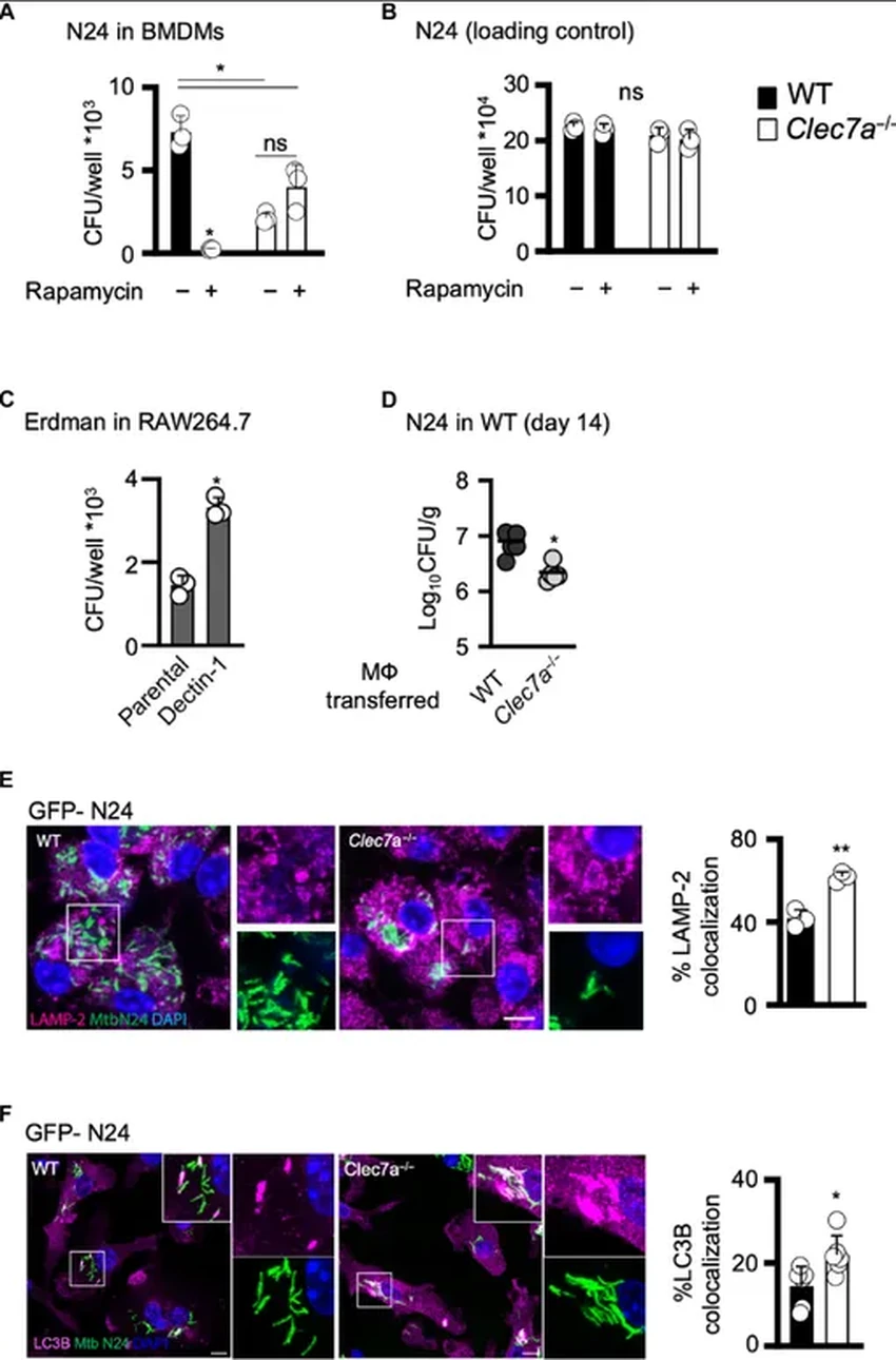 Как туберкулёз обманывает иммунитет, превращая защитные клетки в свой дом