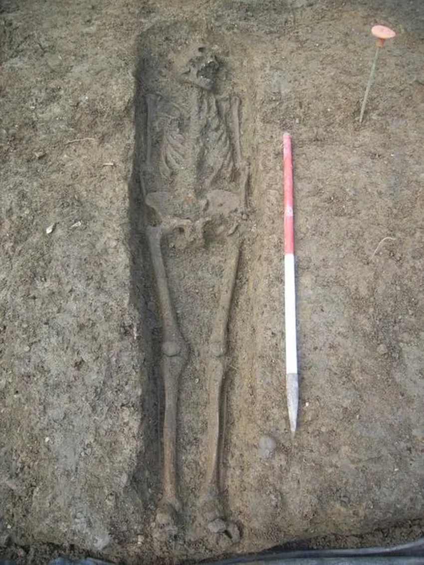 Самый древний случай синдрома Дауна: как генетика изучает людей прошлого