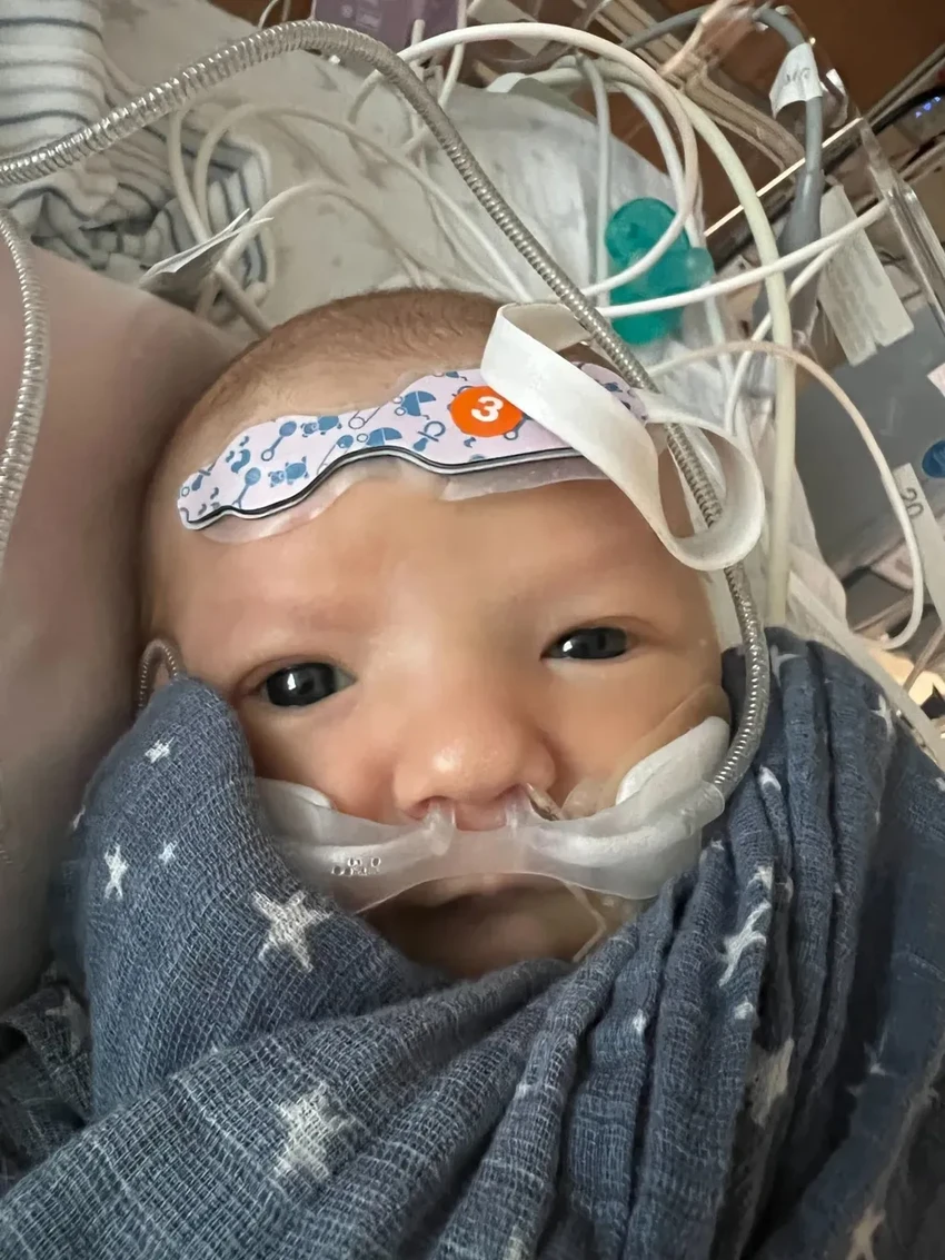 Первый в мире клапан, пересаженный младенцу, растёт вместе с ребёнком