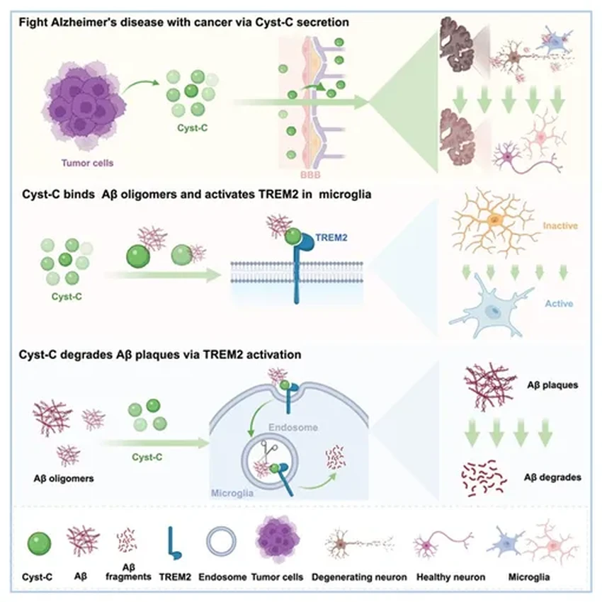 Рак против Альцгеймера: как опухоль неожиданно защищает мозг