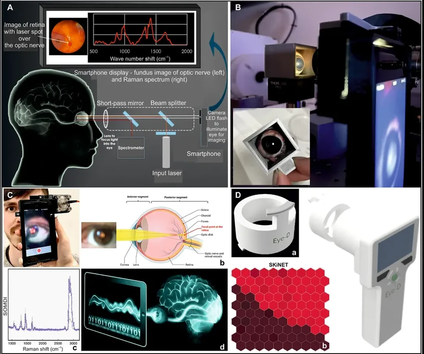 Лазерный сканер диагностирует травму мозга за минуты через глаз