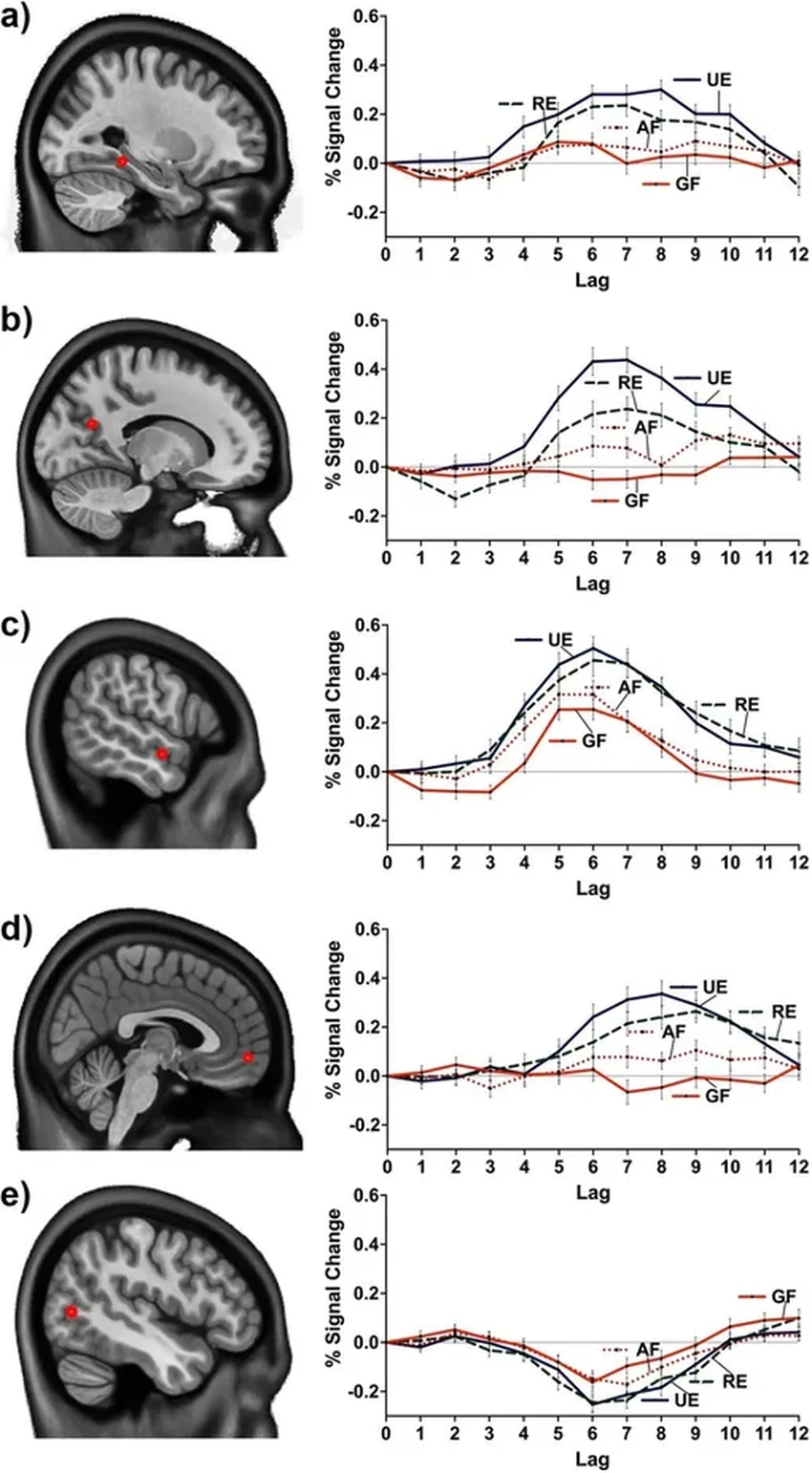 Как мозг управляет памятью: ученые обнаружили единую сеть для воспоминаний и фактов