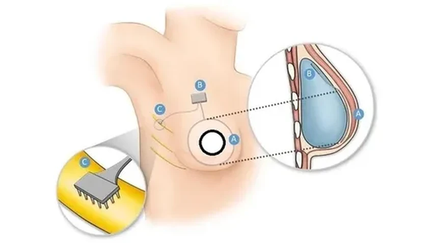 Нежные роборуки и чувстительная грудь: топ-3 прорыва недели