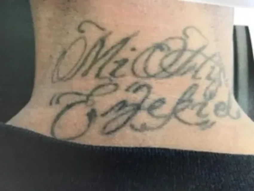 Как удаление криминальных татуировок помогает начать новую жизнь