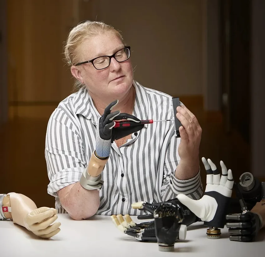 Бионическая рука стала продолжением тела: история пациента