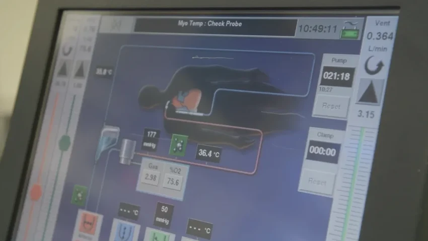 Как пациент выжил 2 дня без легких: искусственный орган как мост к трансплантации