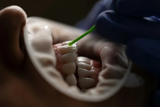 Новое средство от болезней десен на основе грейпфрута и кокоса