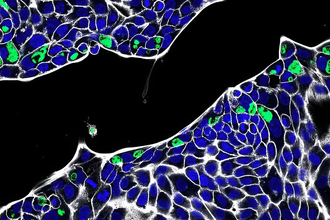 Хламидии скрываются в кишечнике: почему инфекция возвращается после лечения