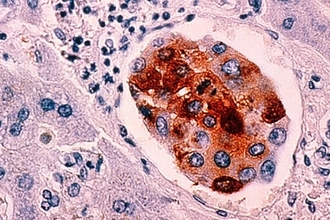 Тёмная сторона белка p53: как защитник генома помогает росту рака