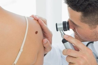 Антибиотики против рака: новая роль терапии при Т-клеточной лимфоме кожи