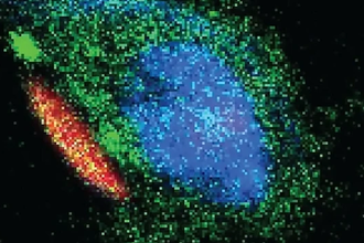 Клеточные «рюкзаки»: новая стратегия лечения черепно-мозговой травмы