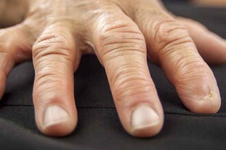 Водородная терапия против ревматоидного артрита: первые успехи в исследованиях