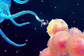 Тяжелая астма: новые мишени для терапии и современные стратегии лечения