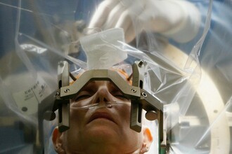 «Электронный нос» для нейрохирурга: как прибор различает рак и здоровую ткань