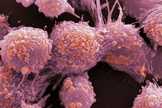 Двойная роль гипоксии в раке: может ли нехватка кислорода останавливать опухоль?