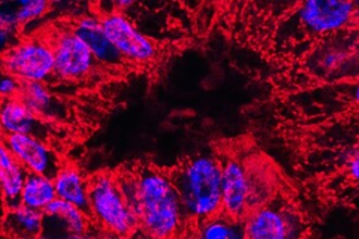 Белок VISTA: ключ к победе над раком поджелудочной железы? Иммунная мишень