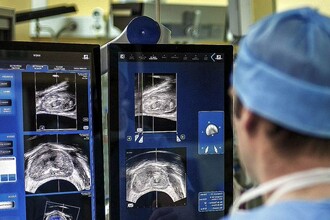 Ученые победили рак простаты у мышей с помощью генетического вируса