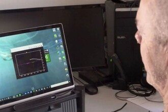 Как Synchron имплантирует мозговой интерфейс через кровеносные сосуды