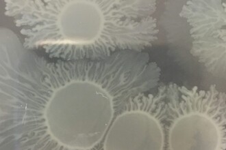 Бактерии-детективы: как A. baylyi находит рак в кишечнике с помощью CRISPR