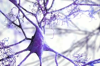 Новый препарат CTx1000 останавливает развитие деменции и БАС на поздних стадиях