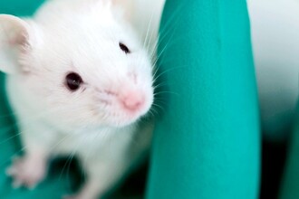 Клеточная терапия против глиобластомы: прорыв в лечении рака мозга